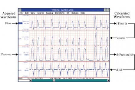 Dataq Advance CODAS